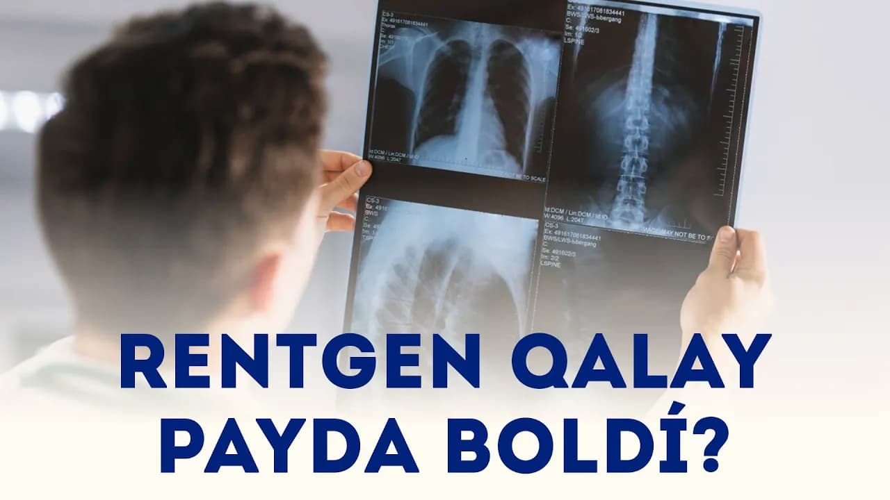 Rentgen: Medicinadaǵı kútilmegen oylap tabılıw | Aydın
